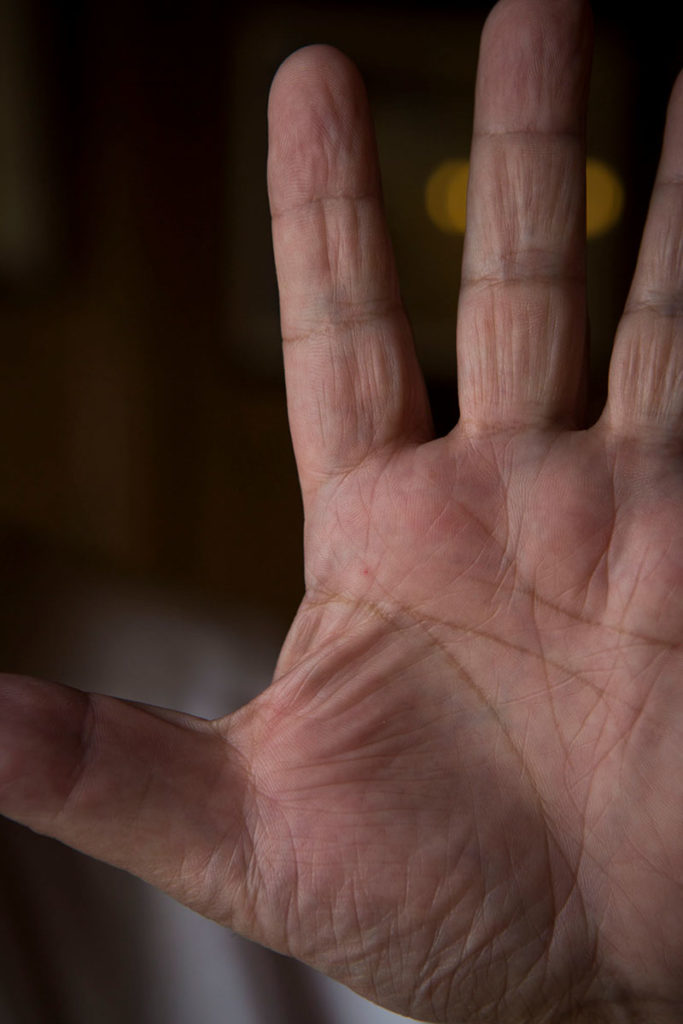 Picture of Denis Vipret's hand, a healer's hand